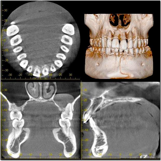 歯や顎の構造を分析 「CT（三次元立体画像撮影装置）」
